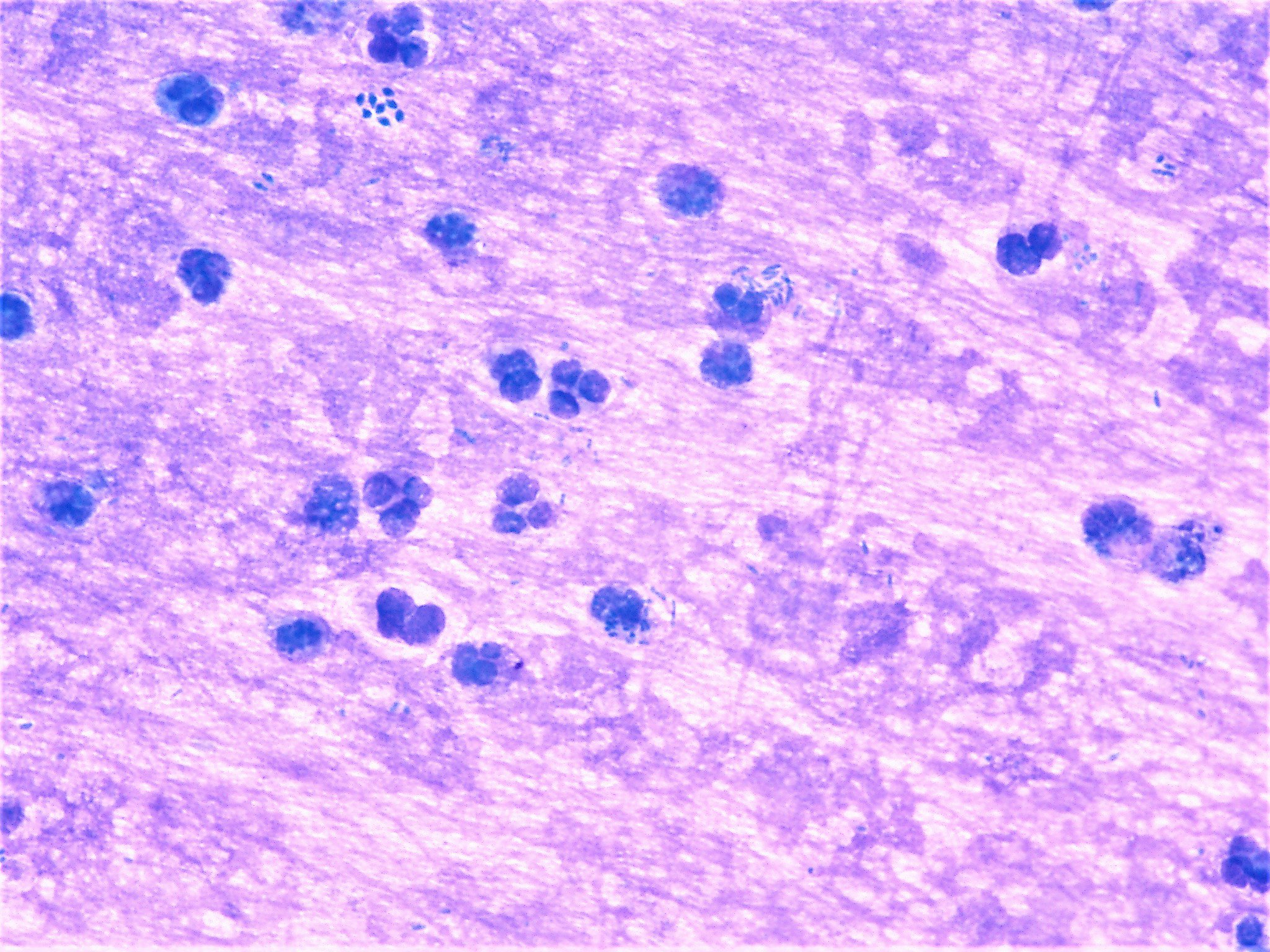 Pathology WalkerAuto Tweet Bot on Twitter "Neutrophils are lunch time