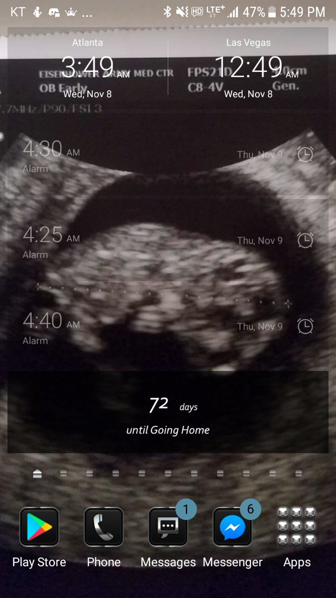 CKxWierdo's tweet image. Such a nice site to look at.   Myself and @krzyPxnda are having a baby.
