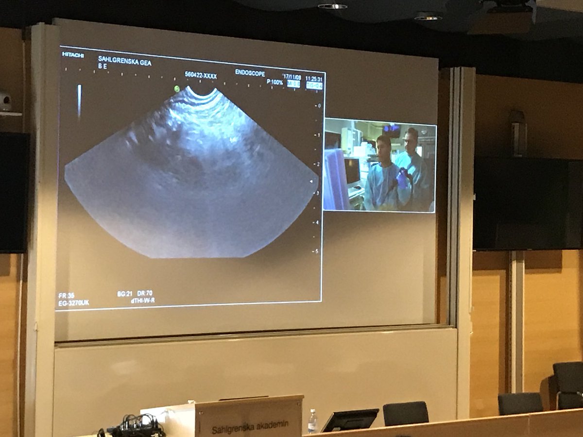 BckJens's tweet photo. Pancreas in the eyes of the endoscopist using latest tech in a livestream session #NordicEUS #eus https://t.co/tLzBZEHGd0