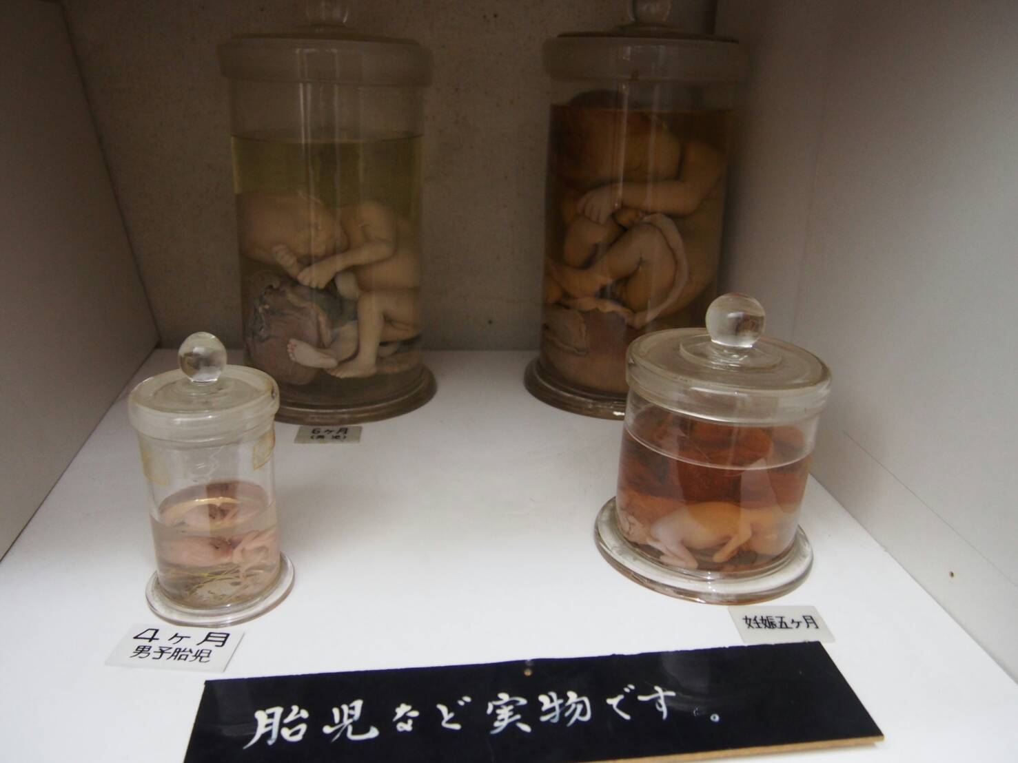 ホルマリン漬け 液体標本