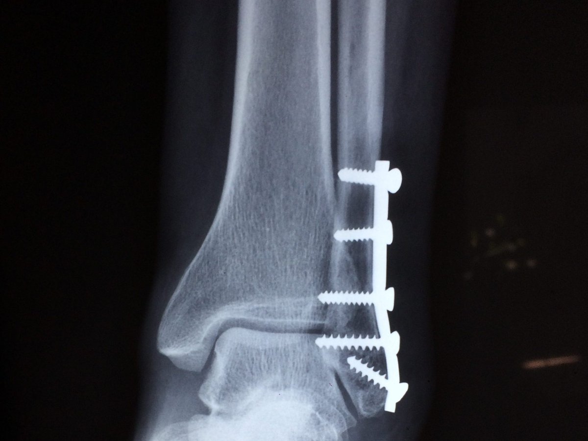 Jacobi/Montefiore EM tweet media