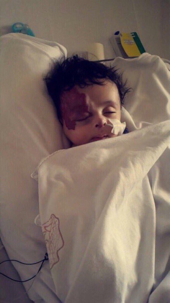 busaad55's tweet photo. ماراح يضرك شي لوساعدته برتويت لعل صوتة يصل
مرابط يناشد من #الحد_الجنوب علاج ابنته التي تعاني من تجمع دموي حول الرقبة والوجه 
 #لاعب_يستفزك_في_فريقك
 #لو_التقينا #تويتر_280_حرف 
#يحدث__الان
 #زد_رصيدك37 #محمد_بن_سلمان_فخرنا_وعزنا https://t.co/ZoPzszOlNM