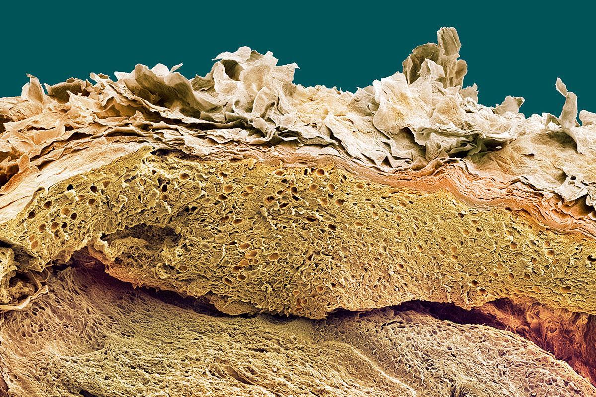 newscientist's tweet photo. Boy with a genetic disease has had almost all his skin replaced https://t.co/IpkzLhCUs0 https://t.co/NAp6bQPa8l