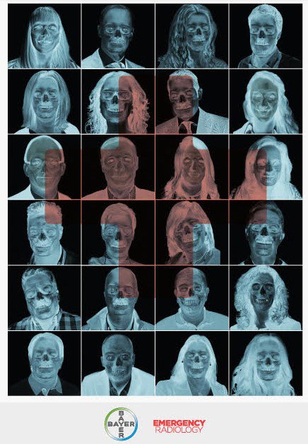 BayerEspana's tweet photo. @BayerPharma Además, nuestros empleados han participado en un concurso de fotografía y se han divertido con un "Emparejados", donde tenían que asociar las caras del equipo de radiología con sus "negativos" en radiografía. ¡Aquí los tenéis! #IDOR2017 https://t.co/dWIVSsFbQT