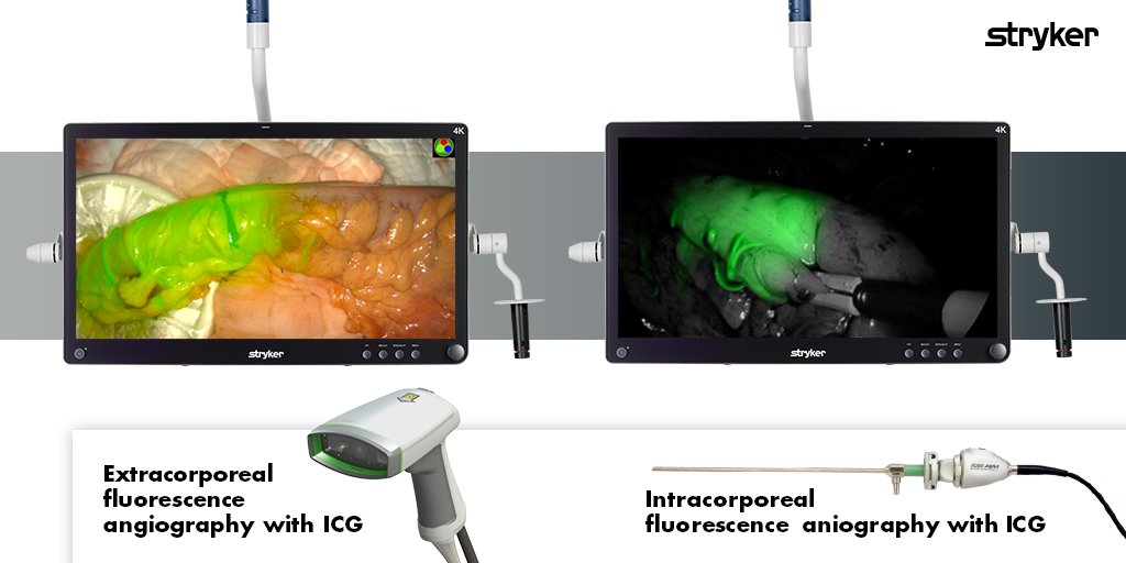 StrykerEndo's tweet photo. 1588 AIM + Spy-Phi. Enabling our customers to see and do more by enhancing cross-specialty visualization https://t.co/8sG0XD6SpY