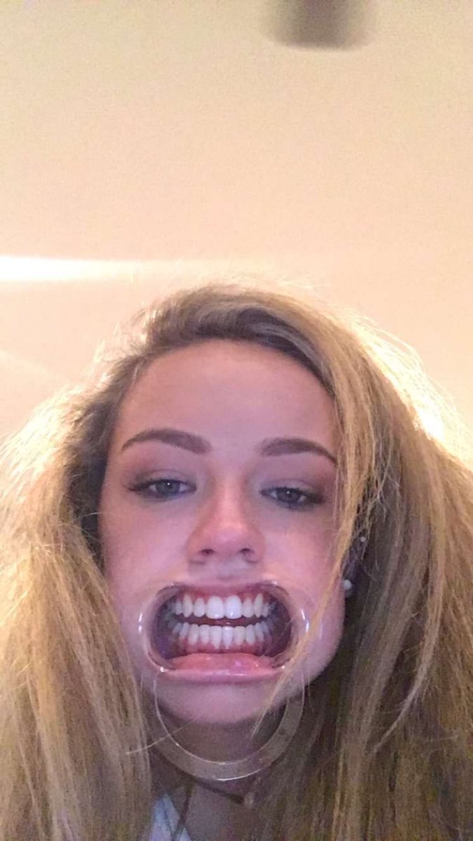 bakerwhitfield's tweet photo. Happy 🅱️irthday Hope! #DatHead #Egg https://t.co/htMxK0qgjc