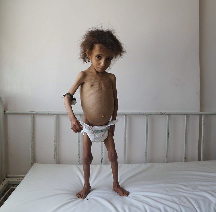 NineInchBride's tweet photo. Saudis Put Yemen Under Total #AidBlockade
https://t.co/54xlL5YSLP
Nightmare scenario for what's already world's worst humanitarian crisis… https://t.co/b2tYmc93TP