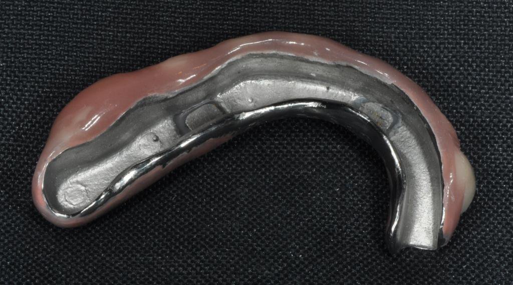 TBDentalLab's tweet photo. New methods of using magnets for implants - something different! #schottlander #Bredent #TrevorBrookerLab https://t.co/z35TO5G3Mt
