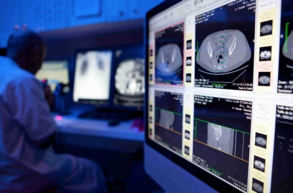 reseauchir's tweet photo. La télémédecine pour les patients malades chroniques par le centre hospitaler de Caen https://t.co/hzGiGc60B6 https://t.co/IvguCwnuJ6