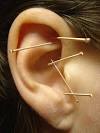 MGhealingenergy's tweet photo. Ear Acupuncture works on your respiratory, digestive and your nervous system bringing your body &amp; mind in perfect #Balance @LivingRoomPlace  @ @TootingPRSS #Tooting #Streatham #balham #selfcare #Wellbeing #communitymatters https://t.co/NZTZDU5hUk