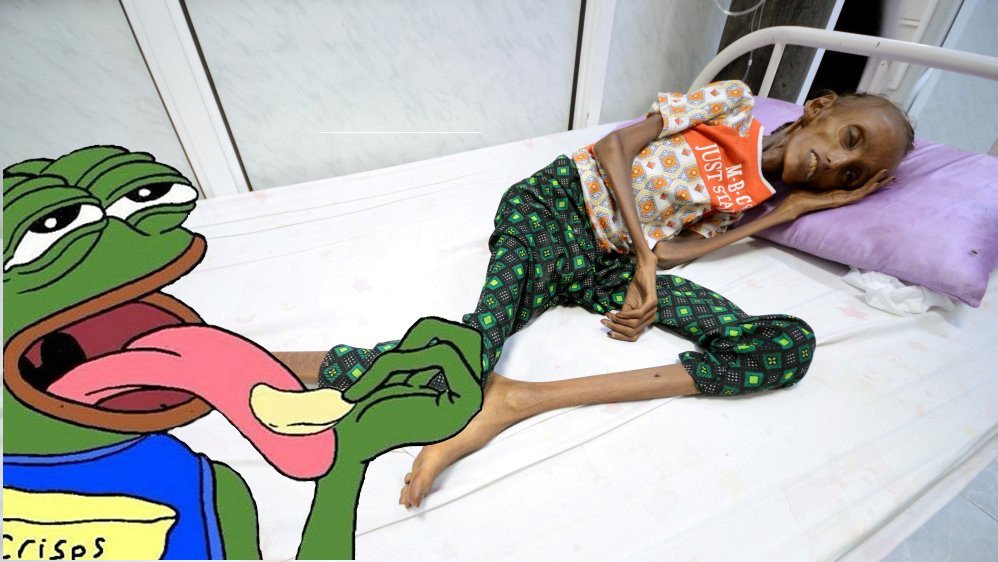 Over9000Pepes's tweet photo. @AJEnglish @UN I don't know what they are complaining about.. They have plenty of food and look extremely healthy. https://t.co/QXrKXNbpCa