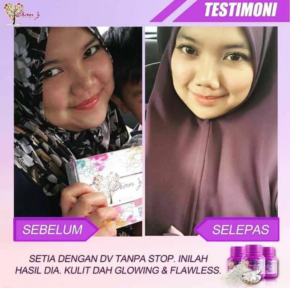 dianz_vit's tweet photo. jerawat merah hilang lepas consume #dianzvitamin. kulit pun makin licin cerah sekata 😍
1 botol 30 biji tahan sebulan 😁

📲 : https://t.co/xusRK0abCd https://t.co/XBtmMxuYzz