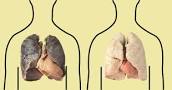 Espinosa1105's tweet photo. fumar daña tus pulmones😡
#ProtejaseDeLasAdicciones https://t.co/XXavGcfEYE