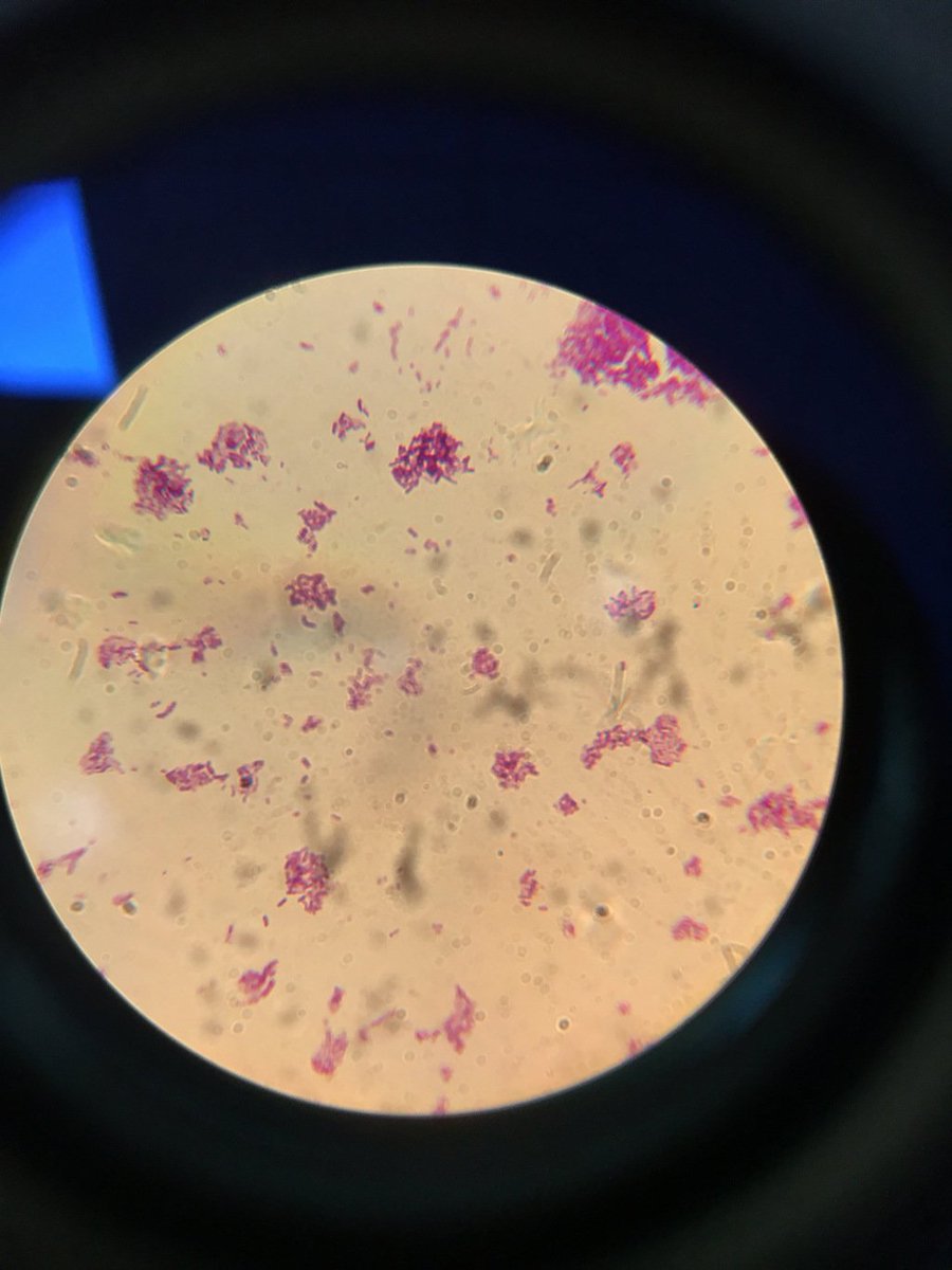 Helenpenk's tweet photo. Microscopes are awesome!!!!! https://t.co/m9AzdBEwsE https://t.co/hkeWrA3Bkj
