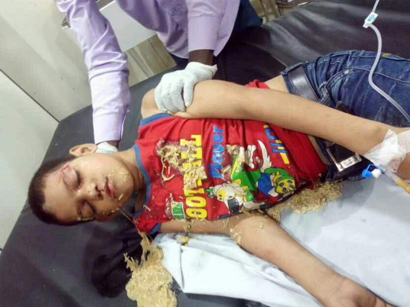 Vineetrishubjp's tweet photo. @digazamgarh @IgRangeVaranasi #Fast_share
Is bachche ka accident hua hai plz koi agar pahchan le to ghar walo ko jankari de life line me h https://t.co/FU0YXCcNcT