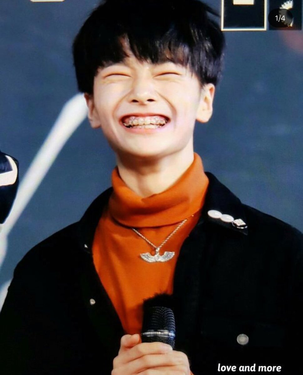 7neocity's tweet photo. jeongin’s eye smile and braces 😁💞💕💗💖 #jeongin #straykids cr: love and more https://t.co/bbZem1SpP8
