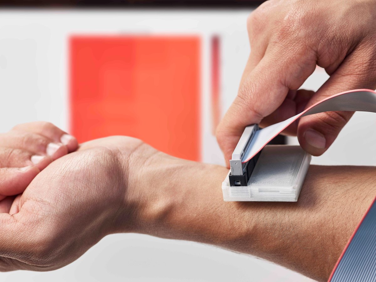 espritdesign's tweet photo. Le sKan, appareil technologique nomade permettant de déceler rapidement un mélanome, remporte le prix du James Dyson Award 2017 https://t.co/JJ1EeXQJ62 #JDA2017 @JDF https://t.co/F1UTNdVrtR