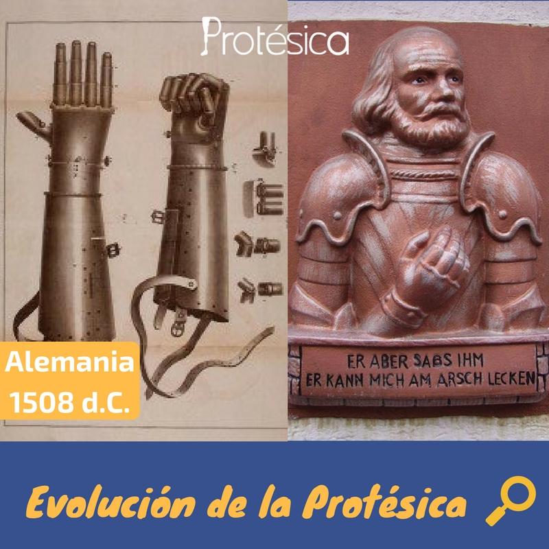 Protesica's tweet photo. La mano de hierro del caballero alemán Gotz Berlichingen es un ejemplo de cómo eran realizadas las #prótesis en siglo XVI d.C. https://t.co/9MqFCAxZ0Z