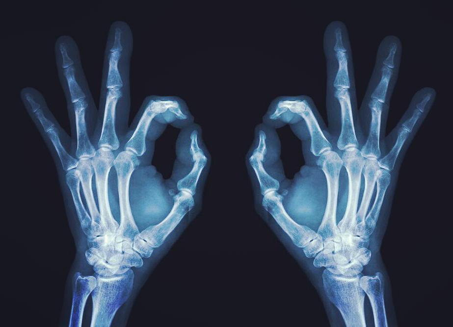 devotioninvites's tweet photo. So I'm stuck on hand rest for the next few days. I dislocated one of my fingers doing DIY (another reason to justi… https://t.co/62xryx6rrF https://t.co/t4NPmCPRUf