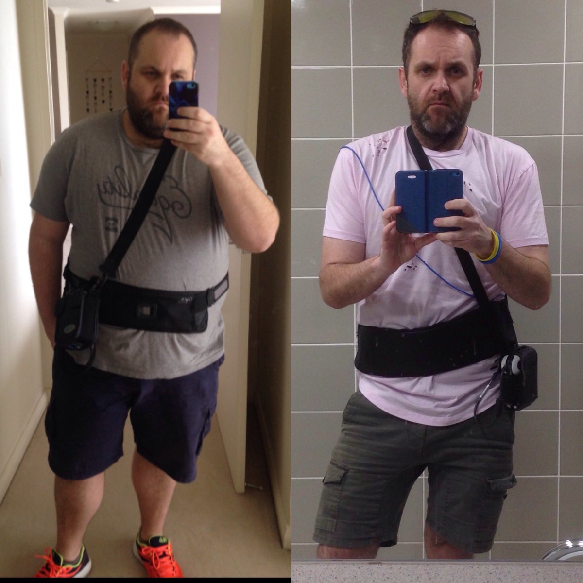 markkirikud's tweet photo. 2 different #pillcam's 18 months apart, 65 kilo less blubber to carry around #weightloss #gaybears #gaybear #exfatty #exchubbybear https://t.co/KQB4WieXNu