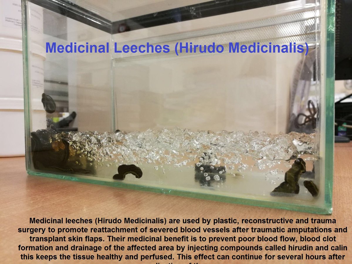 Leicester's Hospitals on Twitter "Who knew leeches were still used? One of our longest serving