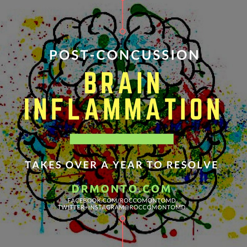 RocoMontoMD's tweet photo. We seriously underestimate the recovery time needed after #concussion, putting our athletes at high risk. #soccer #storelli #TheFountain https://t.co/DBDFk26isb