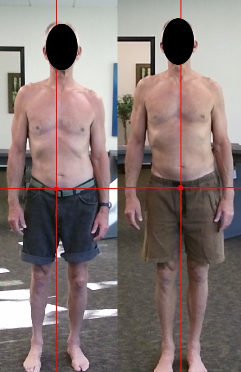 egoscuewc's tweet photo. His shoulders, spine, and legs are now more balanced left to right. https://t.co/7nXdc9XQEA