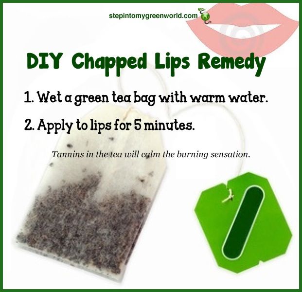 This Chapped lips remedy DIY is worth trying. Please RETWEET to pass on the knowledge
#chappedlips #lips #beauty #DIY #skin #wrinkles #skincare #woman #beautiful #BeautyTip #antiaging #women #fashion #style #makeup #mua #cosmetics #beautyproduct #ThursdayThoughts