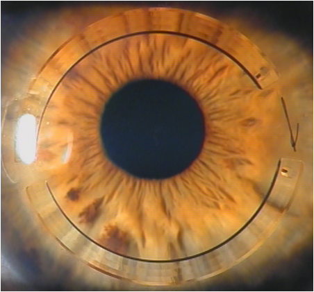 csovision tweet picture