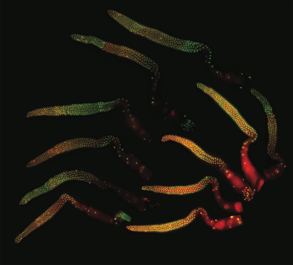 IAmSciArt's tweet photo. Haunting :)
#SWSDB17 submission: miRNA mutant germlines from C. elegans worms, by Amanda Gervais in the @sarur2 lab, at @MDAndersonNews https://t.co/Vrsx7oLHJH