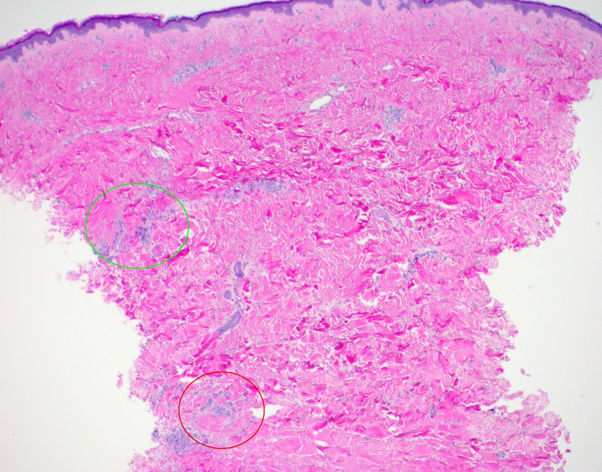 Garth Fraga tweet media