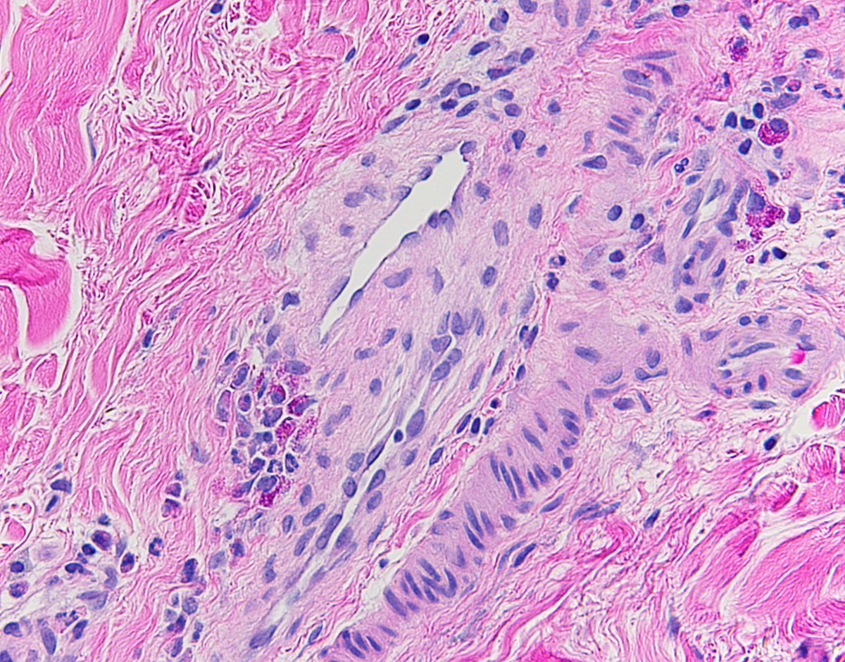 Garth Fraga tweet media