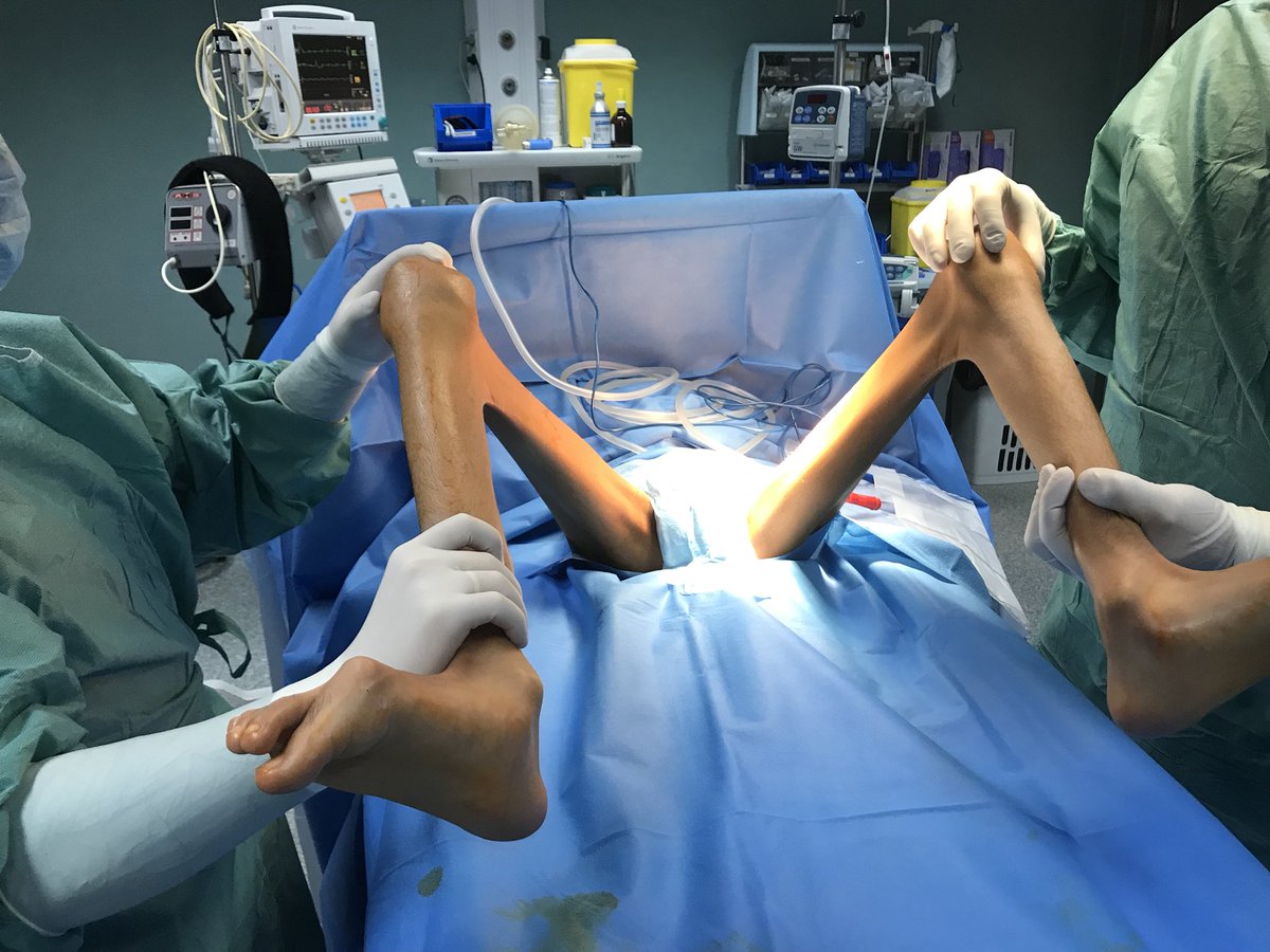 Retos quirúrgicos. Paciente con parálisis cerebral severa.