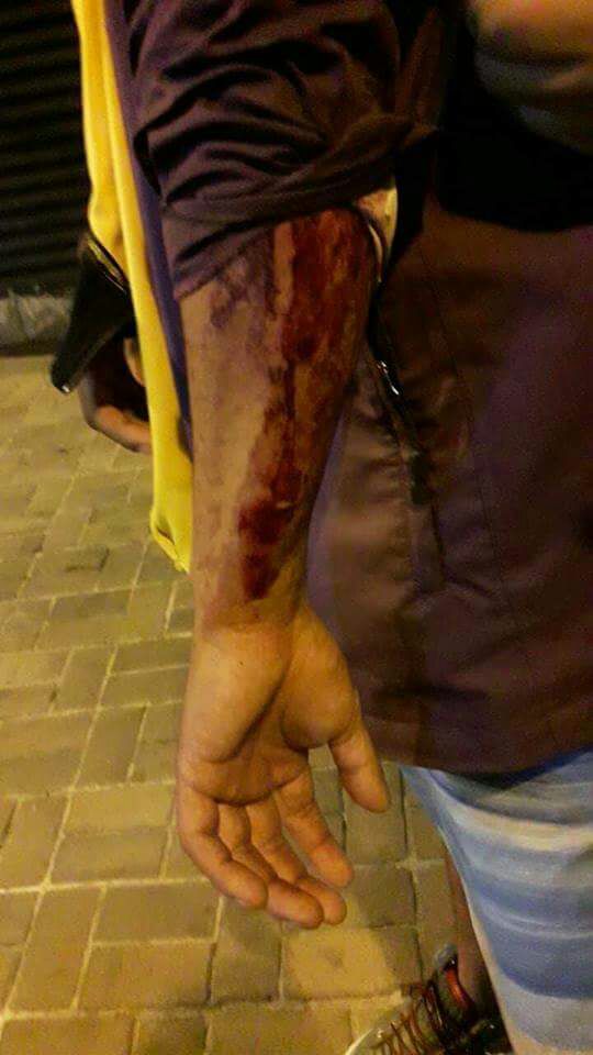 krolBsczn's tweet photo. Este abuso de llevar un uniforme culminó en enfrentamiento no les importó si habían niños o mujeres embarazadas igual lanzaron palo y gas pimienta... https://t.co/LBFMuNCJgA
