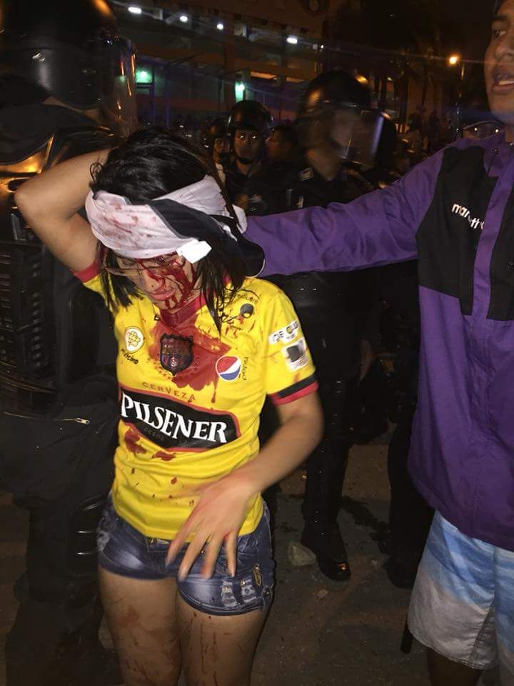 krolBsczn's tweet photo. Este abuso de llevar un uniforme culminó en enfrentamiento no les importó si habían niños o mujeres embarazadas igual lanzaron palo y gas pimienta... https://t.co/LBFMuNCJgA