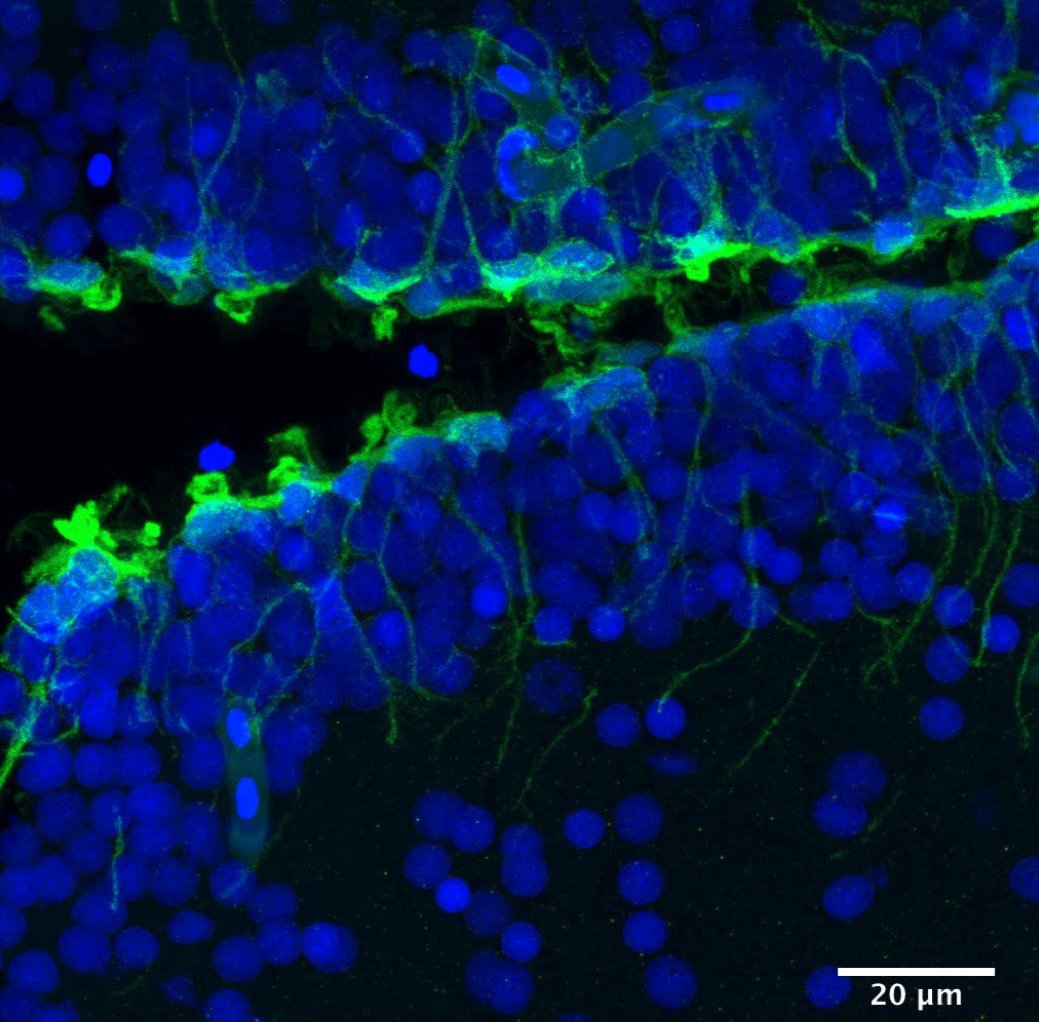 IAmSciArt's tweet photo. "Going with the Flow"#SWSDB17
Ependymal Cell Cilia by Mia Konjikusic from Ryan Gray's lab at @UTAustin https://t.co/9fvv1GW8ww