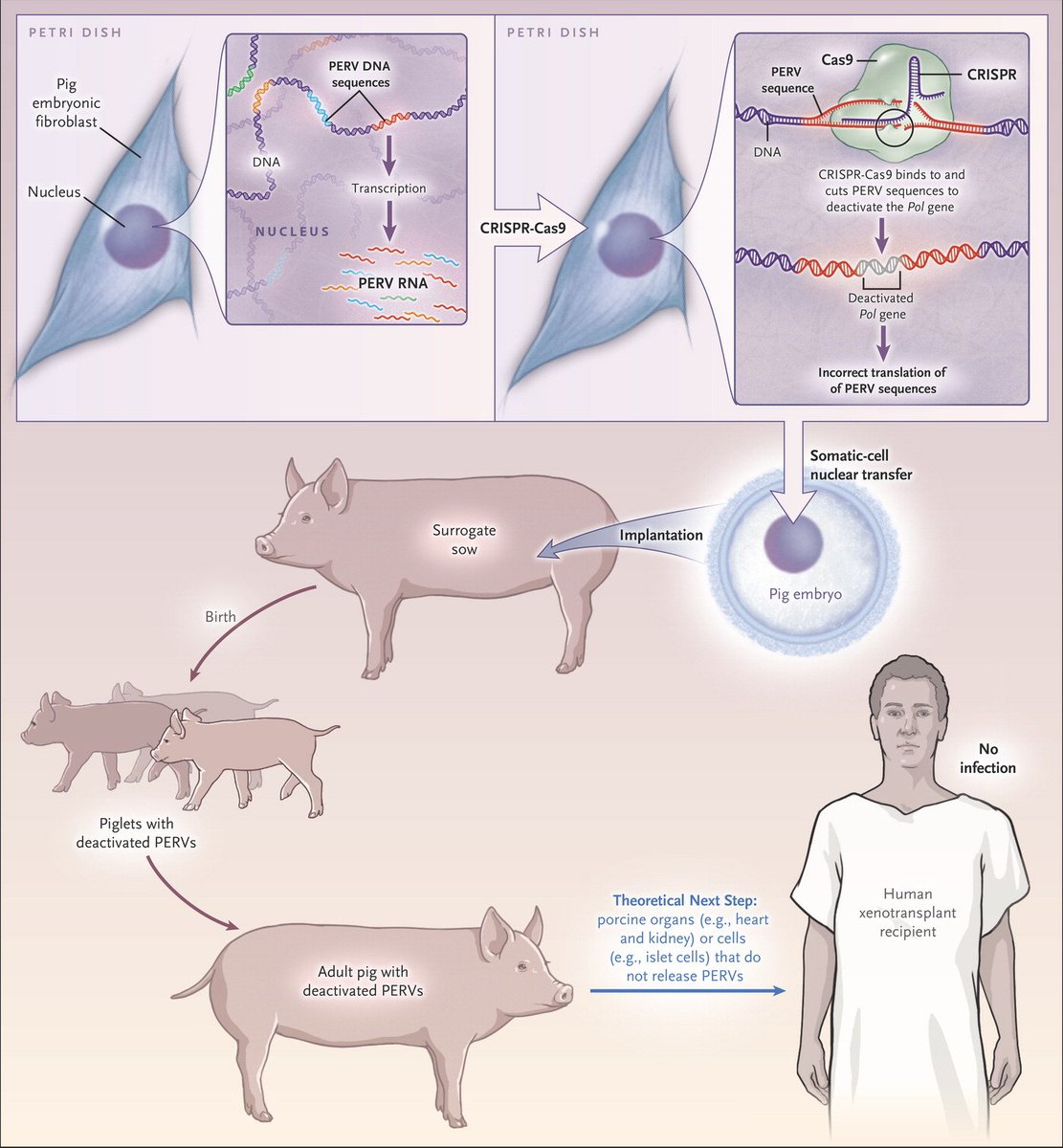 Xenotransplantation Unlocking Hope and Questioning Limits