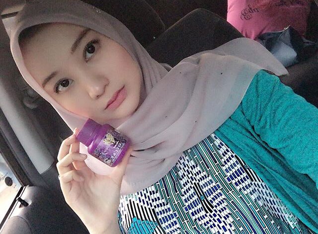 dianz_vit's tweet photo. Masih igt eqahelena? Mangsa toreh beberapa tahun yang lalu. Hbis muka parut sana sini. Eqa consume #dianzvitamin je utk hilangkan parut. Bukan setakat dpt kulit cerah je, jerawat pun tk berani nak singgah!
📲 : https://t.co/SMccyn3LaP https://t.co/3sgNWYD47B