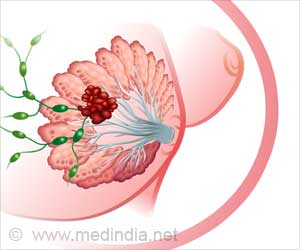 ADevotedYogi's tweet photo. Changes in Normal Mammary Duct Leading to Breast Cancer Could Be Tracked #cancer_ https://t.co/IzKFH0mhHw https://t.co/I2G88gg93z