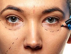Teens and plastic surgery, 10 key things to consider wb.md/2ywsVFt