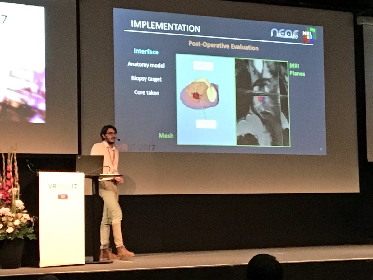 Virtual reality navigation system for prostate biopsy #VRST2017 dl.acm.org/citation.cfm?i…