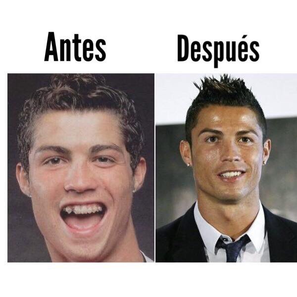 Viernes de “Antes y después”!!! 😁
¿Qué proponen?