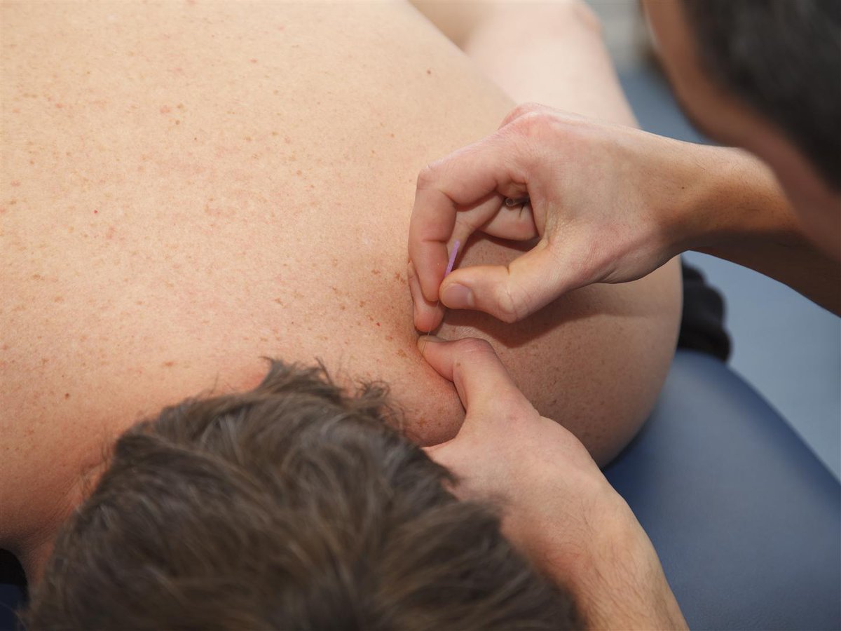 Dry needling, wat is dat precies? Fysiotherapeut Ruud Kassenaar legt het op op medifit.nl/nieuws/dry-nee…