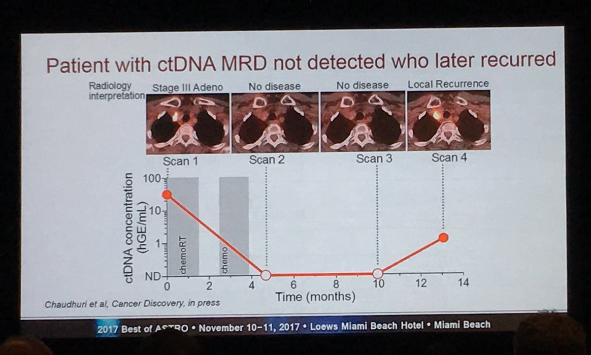 DrewMoghanaki's tweet photo. They’re still talking about @aadel_chaudhuri’s presentation from #ASTRO17. This time by Deb Citrin from @NIH at #BestASTRO17. https://t.co/7d5Fcqrb7G