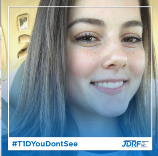 this is my reality. #T1DLooksLikeMe join #teamrowan in hopes of finding a final cure and not just life support like insulin pumps and CGMs  www2.jdrf.org/site/TR?fr_id=…
