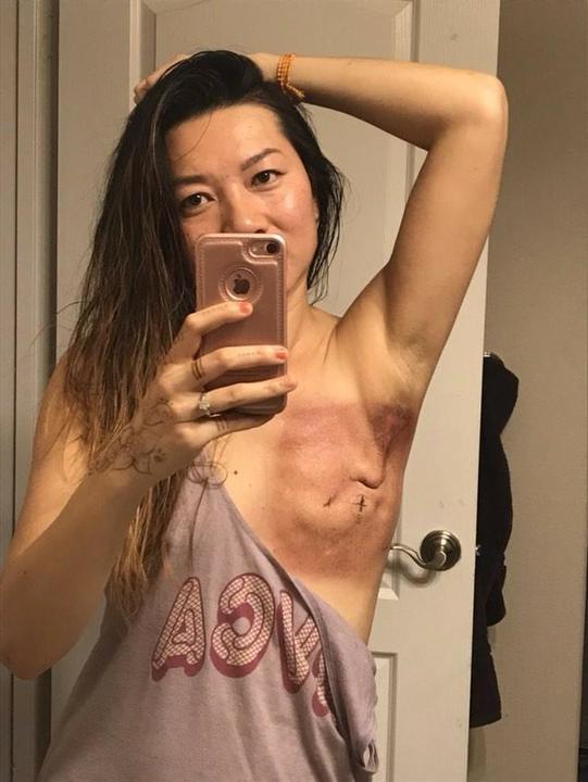 ihadcancer's tweet photo. "I have #cancer and I’m here to rock it. This is 28 out of 30 #radiation treatments. I get tired sometimes, but I continue to work as an #ER #nurse because I wanna kick cancer’s booby. I mean booty" -- Kelly Aguas 😂💅💞 https://t.co/wQEbKLJqFk