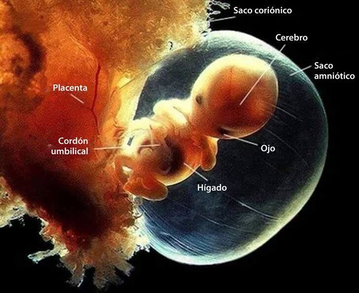 Criame Bebe Con 7 Semanas De Gestacion En Espana El Aborto Es Libre Hasta Las 14 Semanas Terrible Criame Bebe Con 7 Semanas De Gestacion En Espana El Aborto Es Libre Hasta Las 14 Semanas Terrible