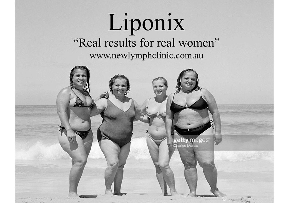 Kristin Osborn (@lymphnewcastle) on Twitter photo 