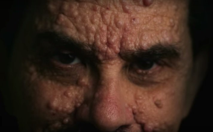 consequence's tweet photo. Watch @FlyingLotus' new short film, #Skinflick, about a man with a unique skin condition: https://t.co/T7DSItmLFa https://t.co/YoqxDnmW0H