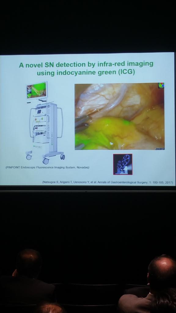 JoeKletzel's tweet image. Fantastic presentation today by Prof Arigami at the 19th Sentinel Node Navigation Surgery meeting in Tokyo on the use of PINPOINT fluorescence in Gastric Lymphatic mapping